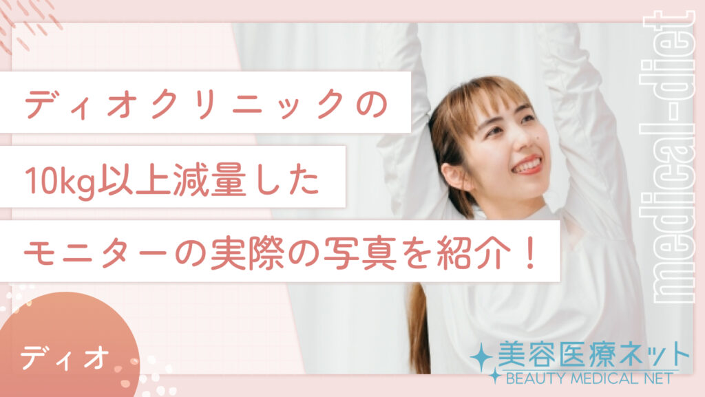 ディオクリニックの10kg以上減量したモニターの実際の写真を紹介！
